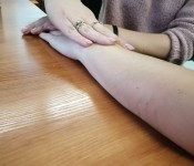 Kurs z terapii ręki